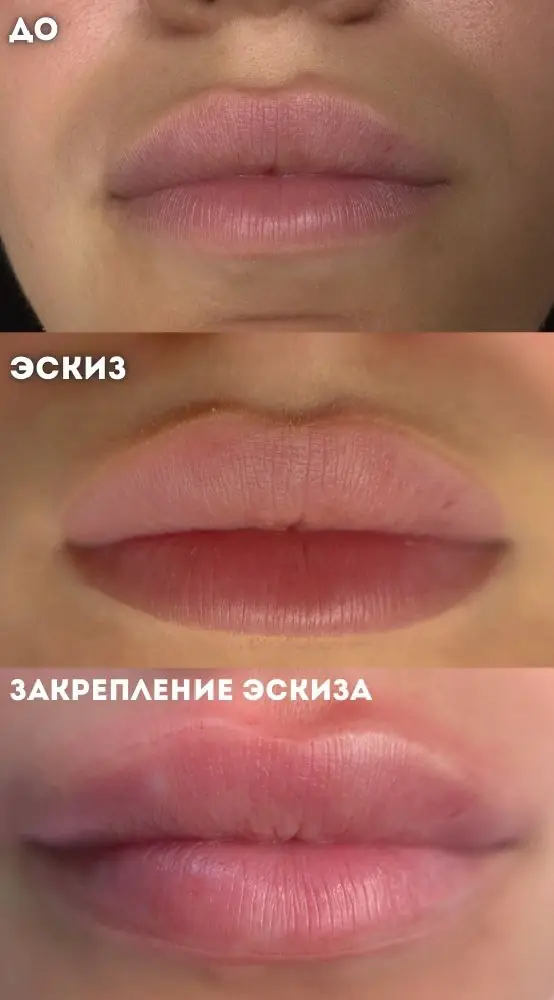 История клиентки Даши до процедуры